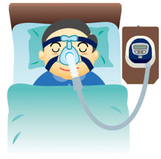 CPAP(シーパップ)療法