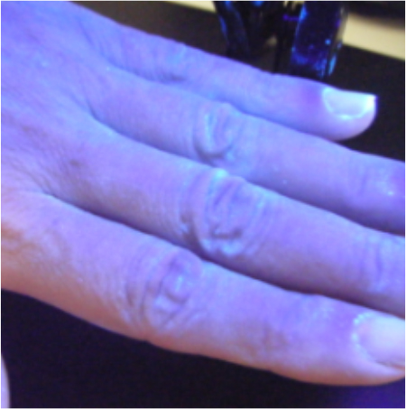 洗い残しの好発部位