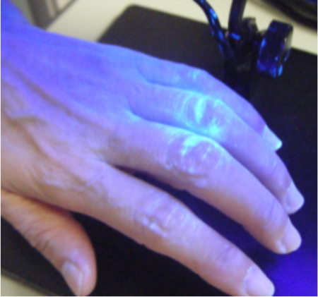 洗い残しの好発部位